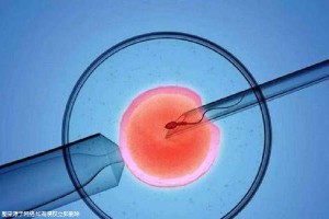 男科主任